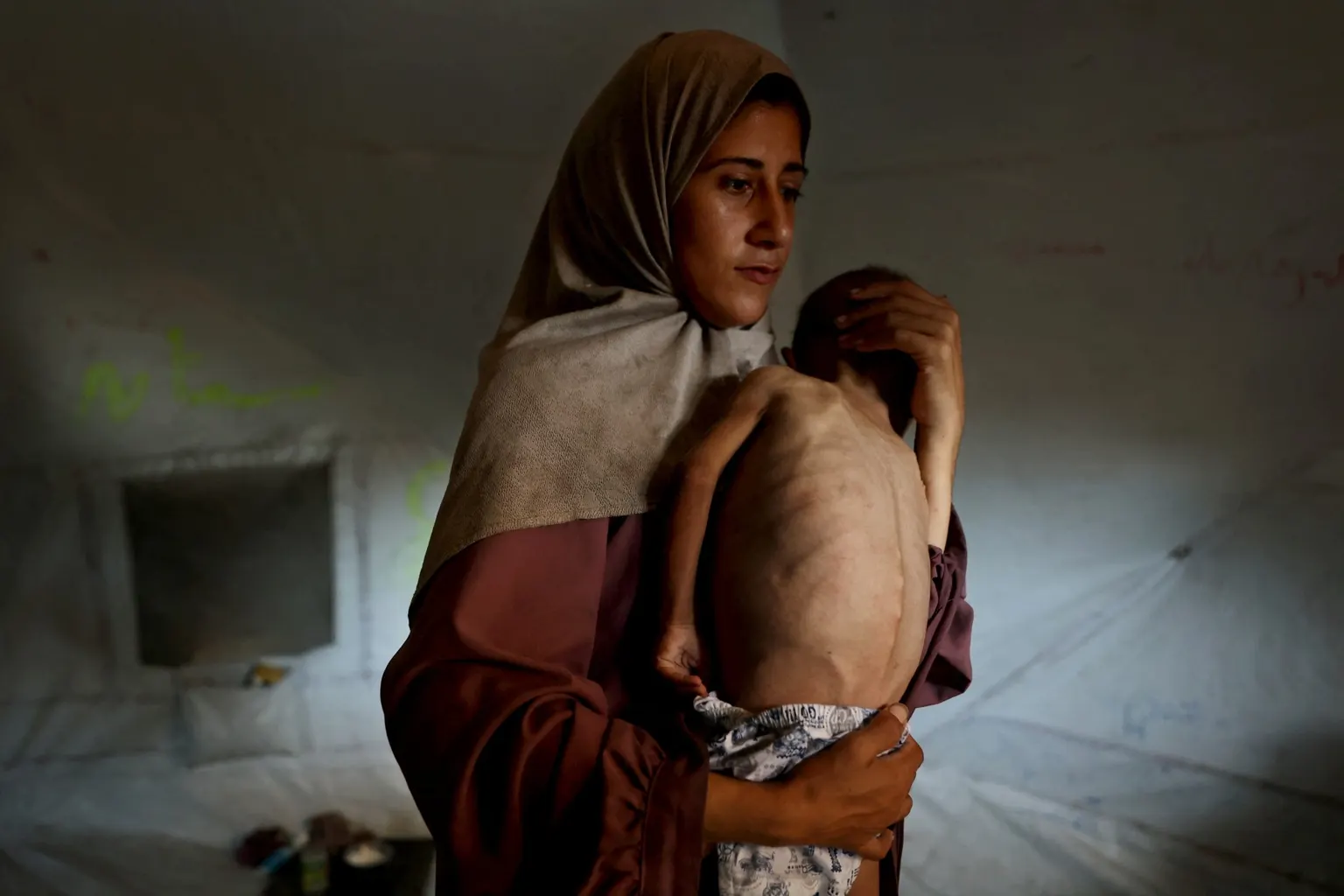 Image accompanying: UN says Gaza malnutrition gains fragile as commercial supplies halt