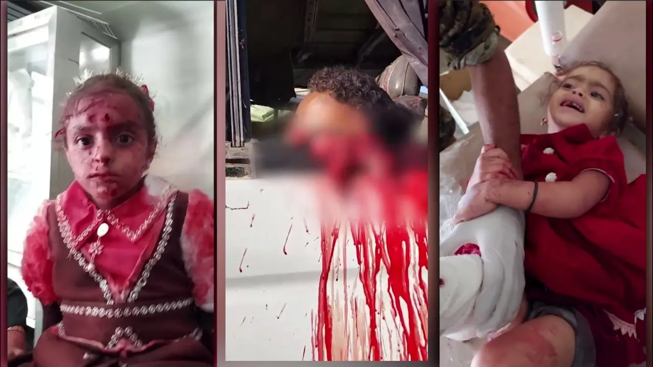 صورة مرافقة للخبر: الصحة: استشهاد وإصابة 11 مواطنًا بغارات للعدو السعودي على تعز وإب